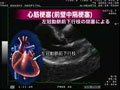 最新心エコー図診断のコツ=疾患編=