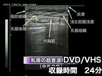 第1巻　超音波検査法