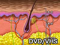 第2巻　しわ・にきび痕のレーザー治療