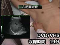 第2巻　胆嚢